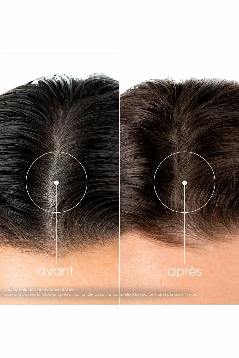 Shampoing fortifiant à la Quinine & Edelweiss bio