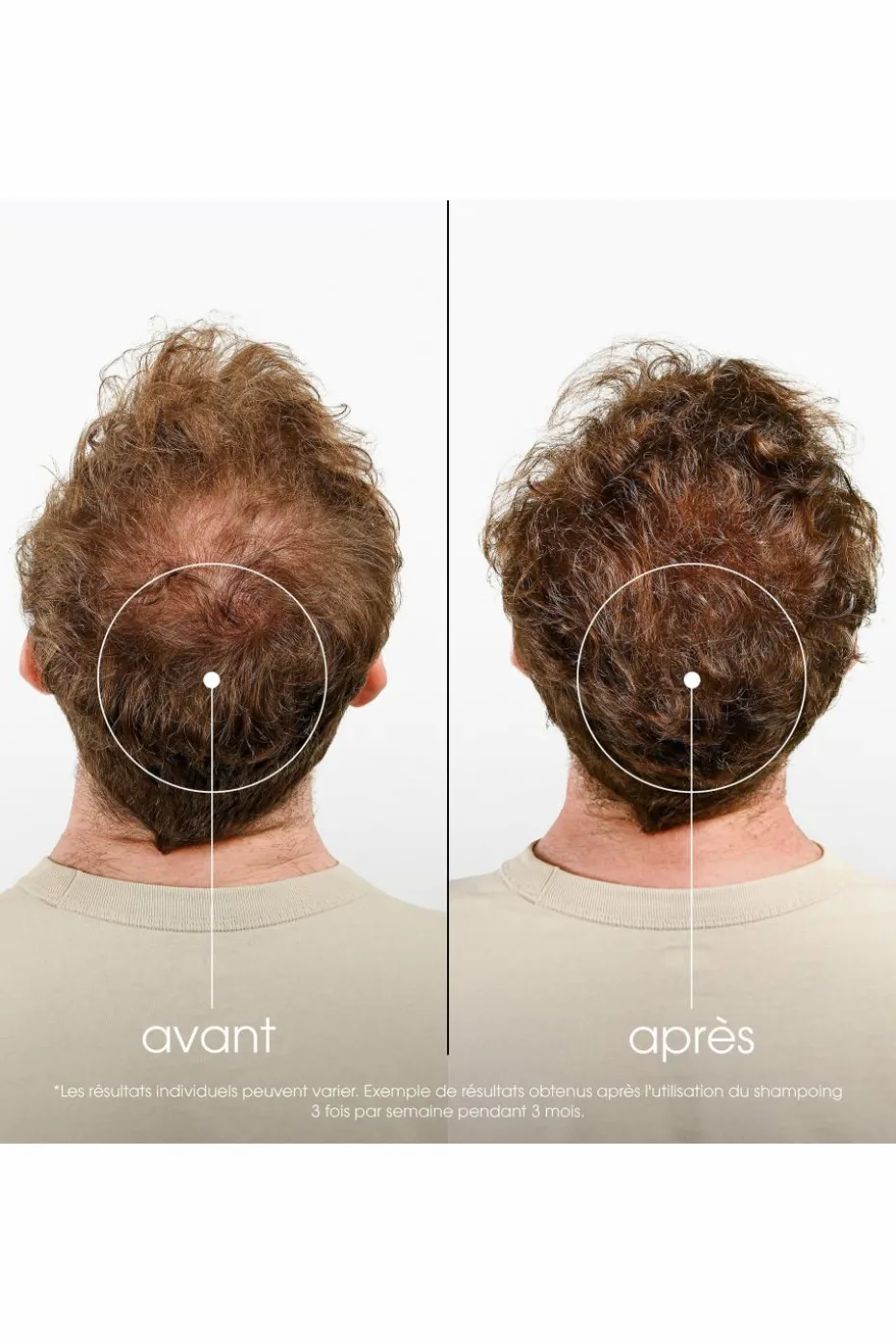 Shampoing fortifiant à la Quinine & Edelweiss bio