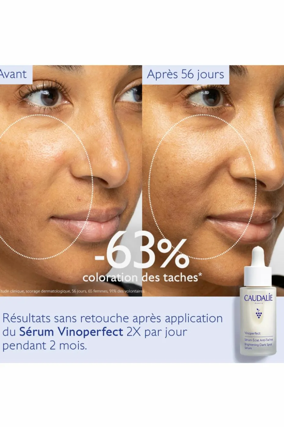Sérum éclat anti-taches Vinoperfect