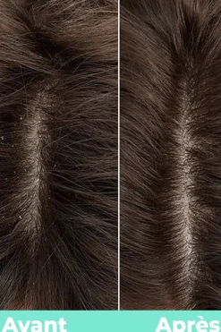 Sérum détox cure SOS pour cuir chevelu hydra équilibrant